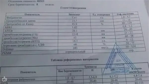 Коагулограмма д димер