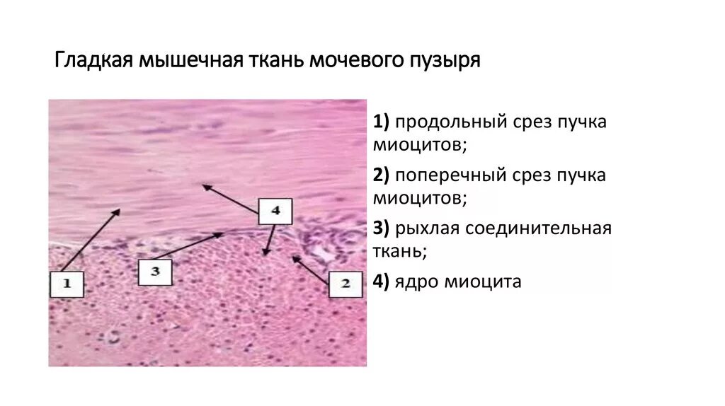 Работа гладких мышц. Поперечная мышечная ткань гистология. Гладкая мышечная ткань срез мочевого пузыря гистология. Гладкая мышечная ткань срез стенки мочевого пузыря. Мышечная ткань гистология препараты.