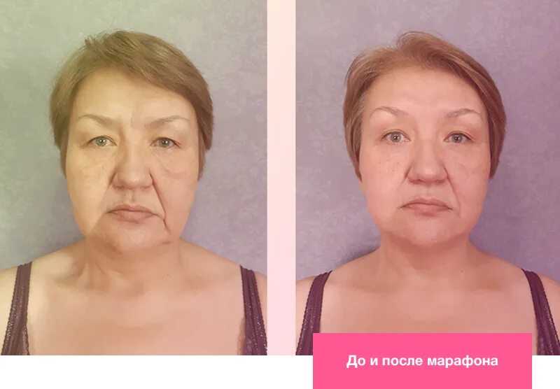 Отекает лицо по утрам причины у женщин