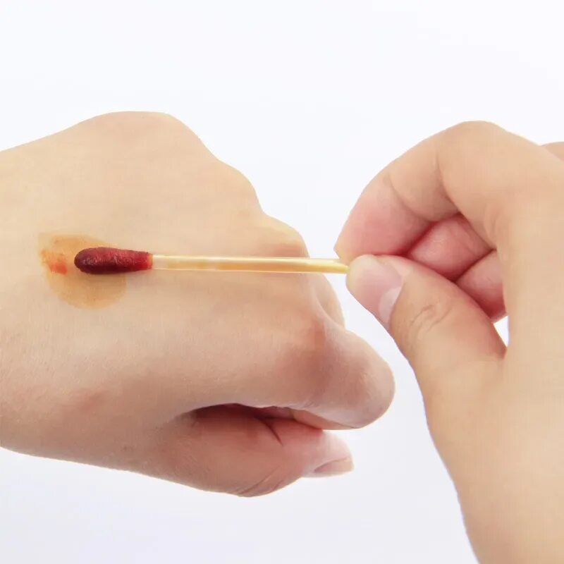 Ссадина промывается чистой водой и обрабатывается _____________. Йод или зеленка при обработке ран. При обработке раны йодом. Ссадины йод. Обработать рану йодом или зеленкой.