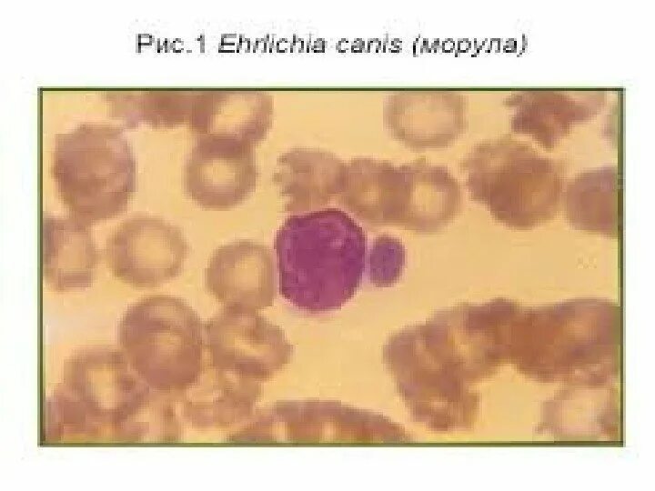 Эрлихиоз клещевой. Моноцитарный эрлихиоз.