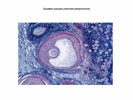 Пузырек фолликула