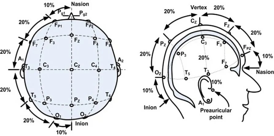 Ээг 10 10. Схема расположения электродов 10-20 ЭЭГ. ЭЭГ наложение электродов схема 10-20. Схема наложения электродов ЭЭГ. Схема ЭЭГ 10-20.