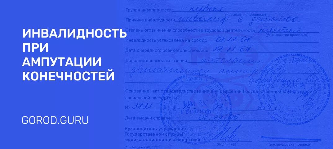 Дают ли инвалидность после. Какая группа инвалидности при ампутации ноги. Инвалидность при ампутации ноги. Ампутация ноги группа инвалидности. Потеря конечности какая группа инвалидности.