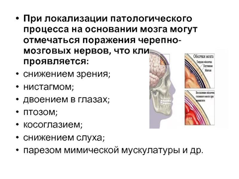 Симптомы поражения черепных нервов. Локализация патологического процесса. Поражение черепно-мозговых нервов. Локализации поражение черепно-мозговых нервов. Воспаление оболочек головного мозга.