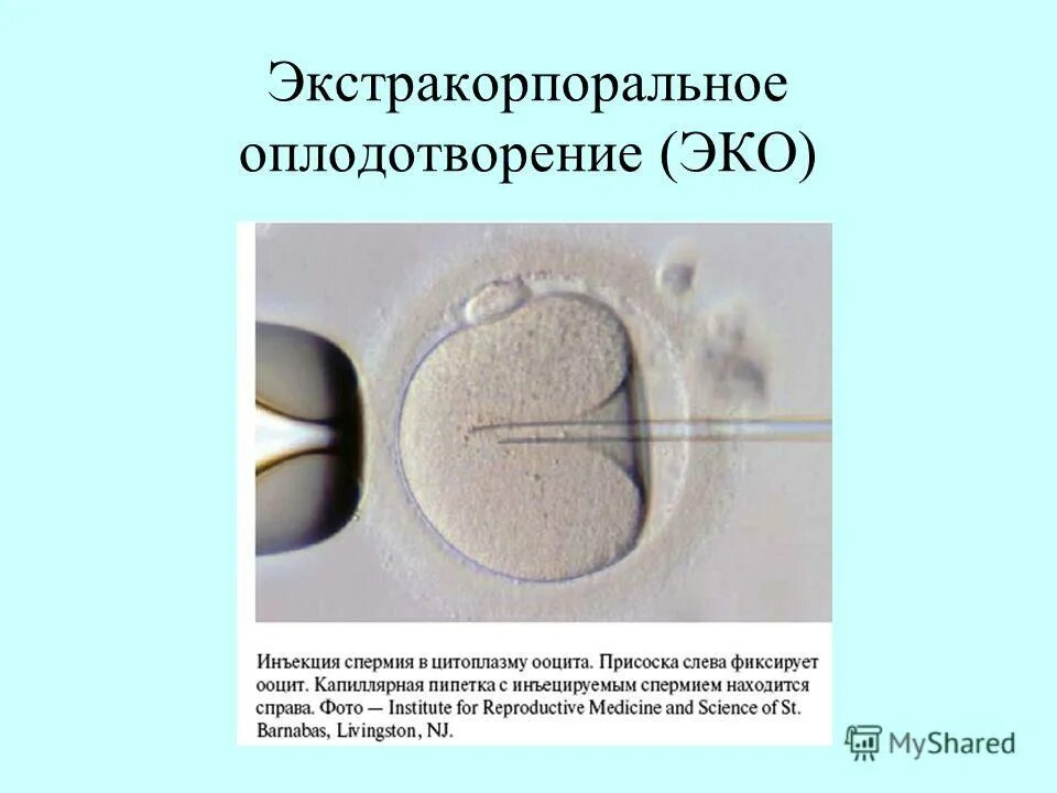 Экстракорпоральное оплодотворение. Искусственное оплодотворение. Искусственное оплодотворение этапы. Эко это искусственное оплодотворение.