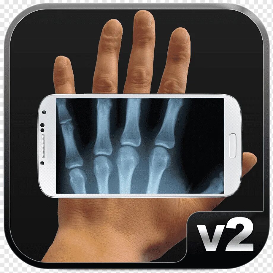 Платный рентген. Рентген-сканер 2xr51. X-ray рентген. X ray сканеры рентген для проверки. Рентген смартфона.