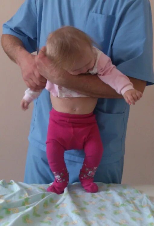 Правосторонний гемипарез очаг поражения. Спастический терарапарез. Дцп спастический тетрапарез. Тетрапарез что это такое. Дцп тетрапарез.