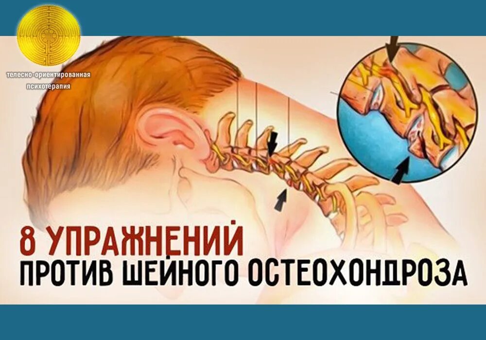 Боли при шейном остеохондрозе как избавиться. Остеохондроз шейного отдела. остеохондроз шейного отдела боли. профилактика остеохондроза шейного отдела позвоночника. 8 упражнений против шейного остеохондроза.