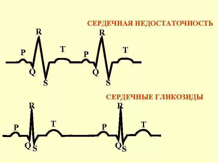 Сердечные гликозиды вводят. Сердечные гликозиды классификация. Сердечные гликозиды препараты. Действие сердечных гликозидов на сердце. Сердечные гликозиды фармакология.