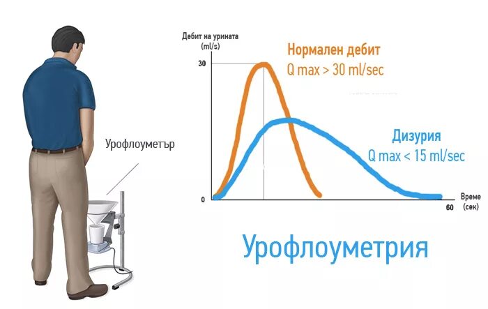 урофлоуметрия где сделать. урофлоуметрия дгпж. что такое урофлоуметрия у мужчин. нормальная урофлоуметрия. типы кривой при урофлоуметрии.