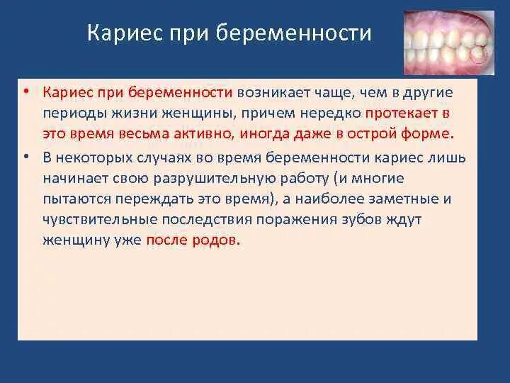 Можно ли лечить зубы на ранних сроках. Кариес зубов при беременности. Влияние кариеса на беременность. Профилактика кариеса у беременных. Профилактика кариеса зубов у беременных.