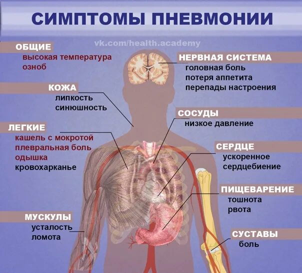 Ноющие боли в легких. Основные симптомы пневмонии. Легкие болят при пневмонии. Пневмония симптомы у взрослых.