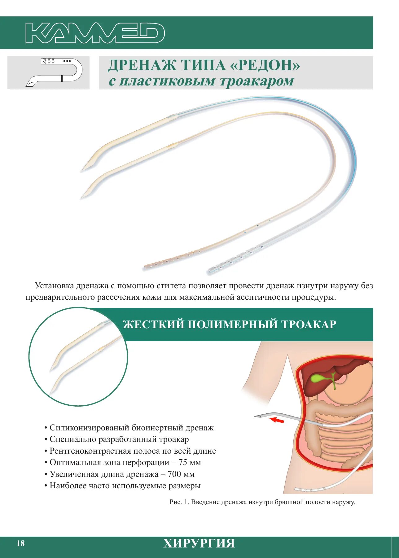 активное дренирование раны по редону.