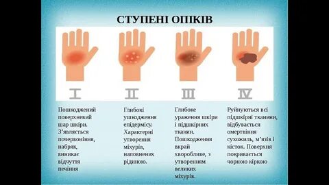 Ступінь