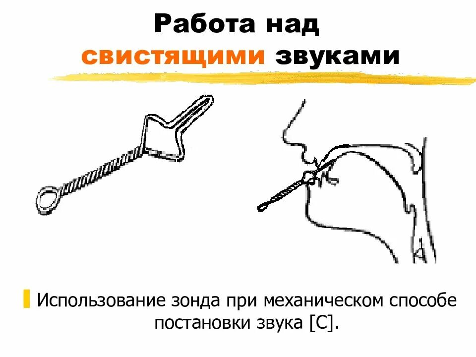 Между собой с помощью специальной. Постановка звуков с помощью зондов. зонд для свистящих звуков. постановка звука с механическим способом. постановка звуков с помощью логопедических зондов.