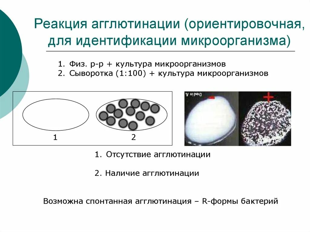 Постановка реакции агглютинации. Ориентировочная реакция агглютинации микробиология. схема постановки реакции агглютинации. диагностическая реакция агглютинации. постановка ориентировочной реакции агглютинации.