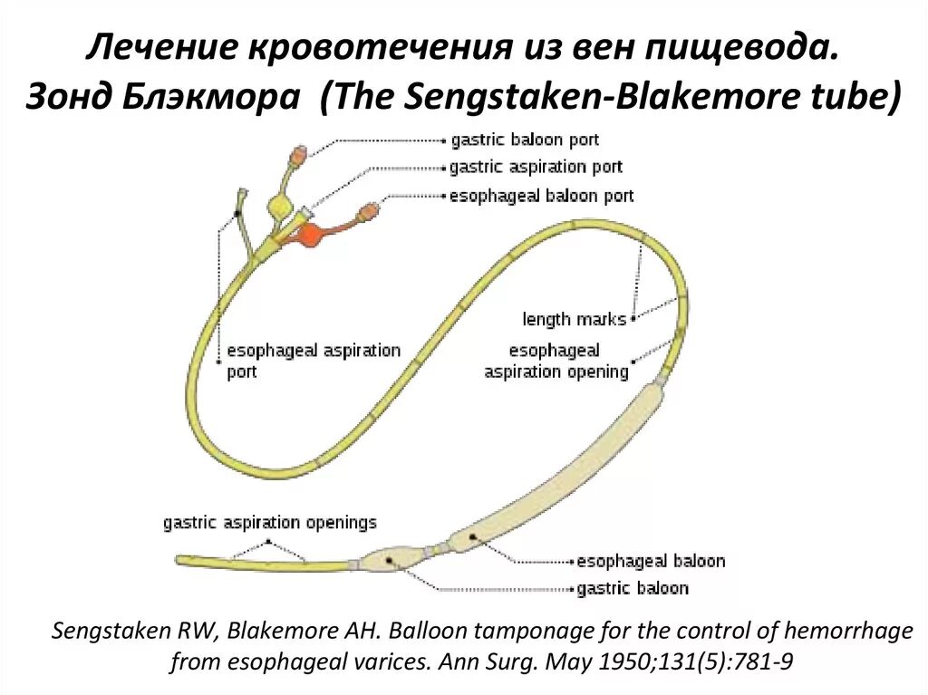 Кровотечение из желудка пищевода. Зонд Блэкмора для остановки кровотечения из вен пищевода. Баллонная тампонада зонд Блэкмора. Методика постановки зонда Сенгстакена-Блэкмора.