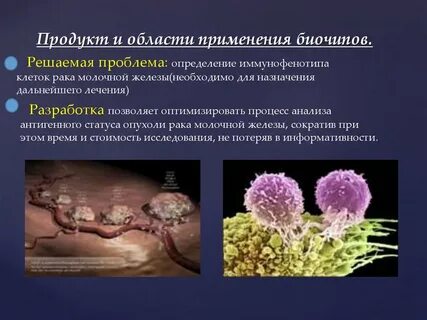 Тройной негативный рак молочной