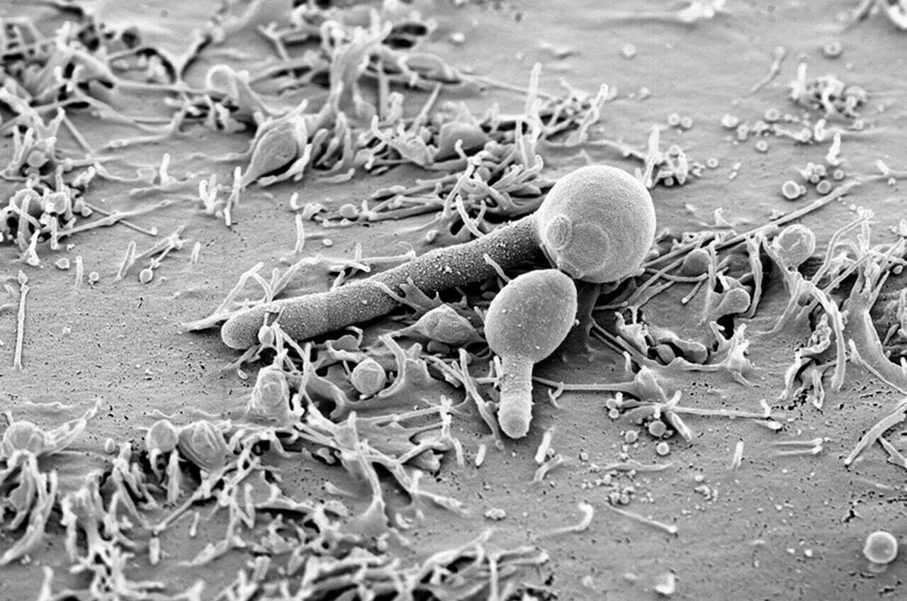 Candida albicans toxin plays a special role in the colonization of the digestive