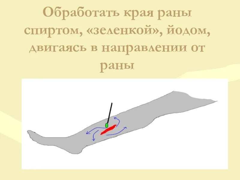 Зеленкой можно мазать открытую рану