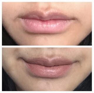 Bare lips