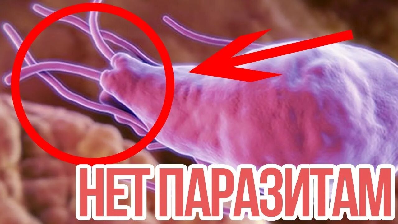 Вылечить паразитов