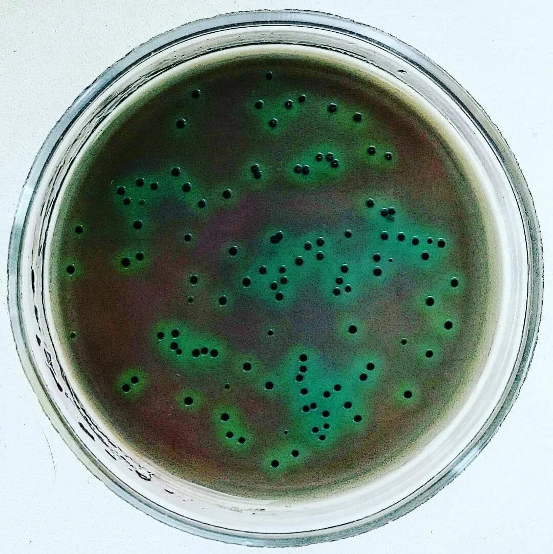 Холера питательные среды. Salmonella typhi микробиология. Salmonella Typhimurium микробиология. Сальмонелла на чашке Петри.