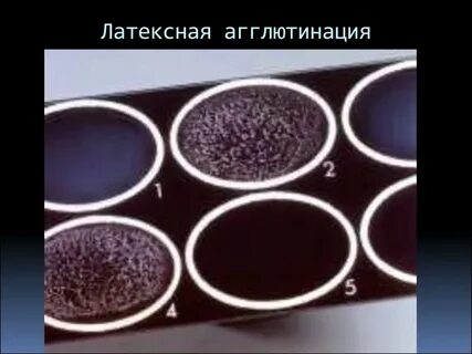 Латекс агглютинация