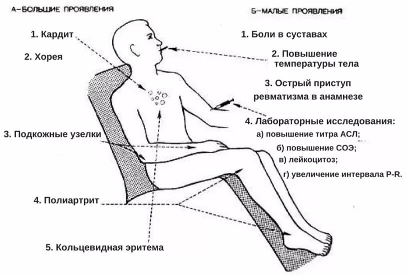 Температура боли в суставах сыпь