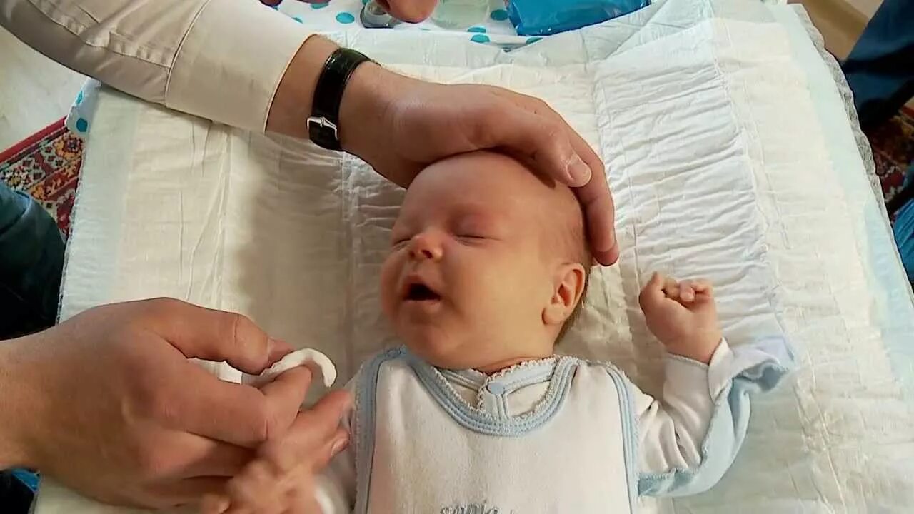 Почему у ребенка мешки