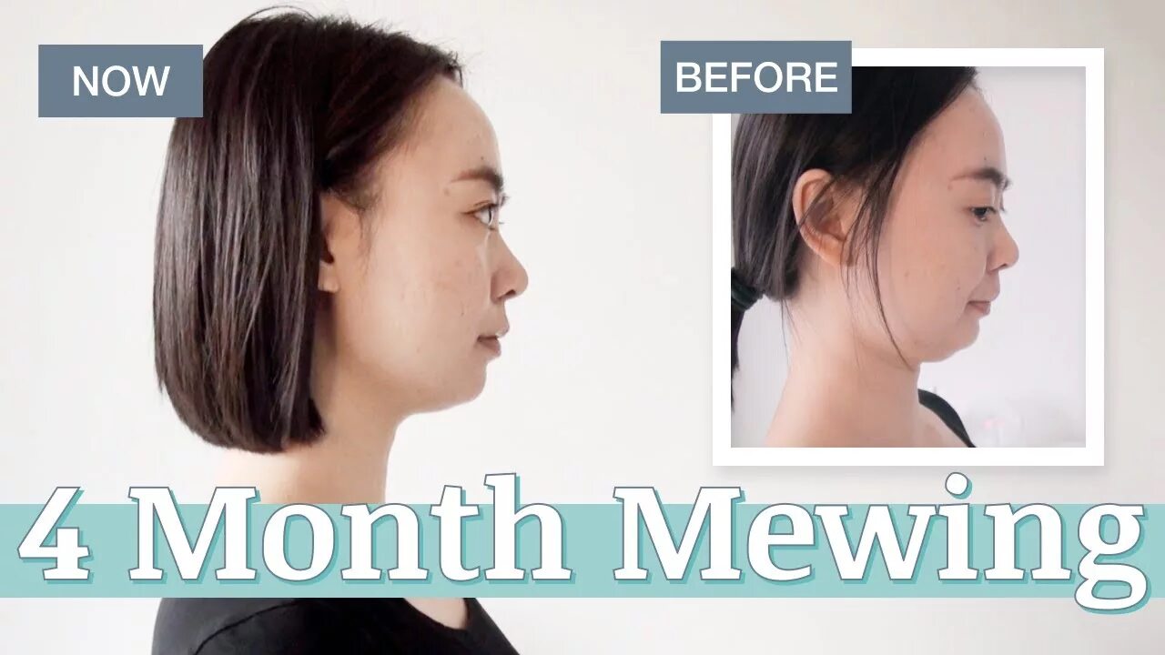 Mewing Transformation. Mewing before and after. How to do mewing. Mewing Chad. Mewing mp3