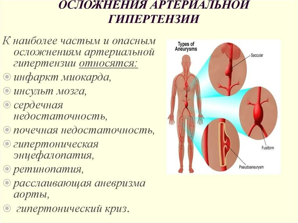 Осложнения заболевания гипертонической болезни. Осложнения проявления гипертонической болезни. Гипертонической болезнь осложнения артериальной гипертензии. Гипертоническая болезнь сердечная форма осложнения. Артериальное давление осложнения