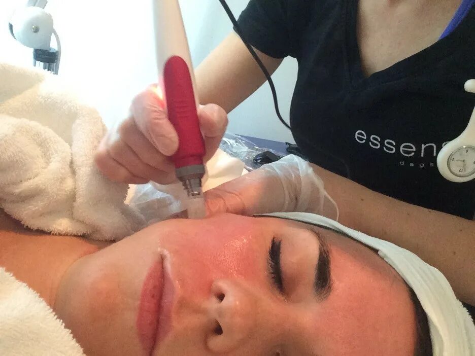 Мелис дермапен м2. Фракционная мезотерапия дермапен. Аппарат дермапен для фракционной. Фракционная мезотерапия дермапен. Дермапен работа.