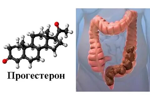 Запор после переноса эмбрионов
