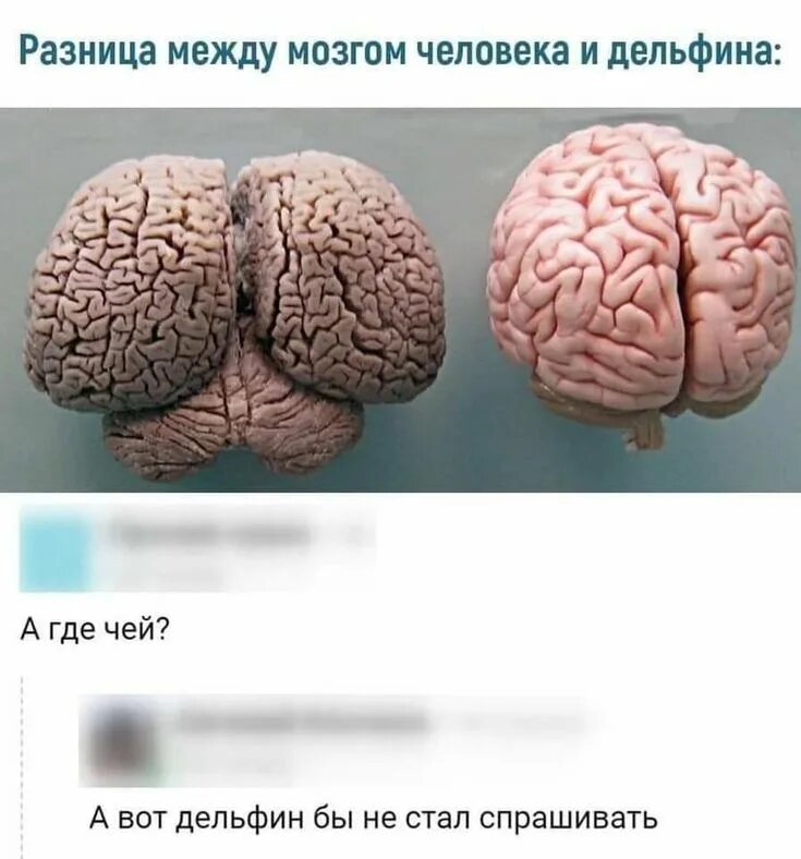 Что такое у тебя есть мозги