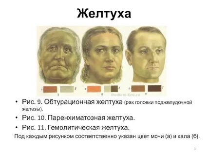 Желтуха у взрослых заразна или нет