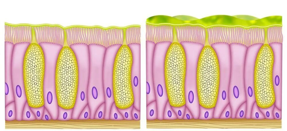 Мерцательный эпителий слизистой оболочки носа. Goblet Cells. Goblet Cell of the trachea. Ciliated Cells.