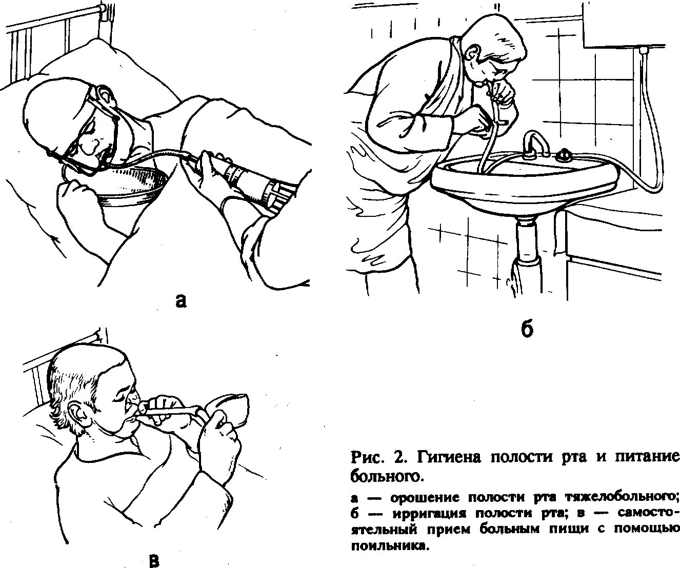 Туалет полости рта. Туалет полости рта тяжелобольному. Питание больных с повреждением ЧЛО. Гигиена полости рта тяжелобольного. Туалет полости рта тяжелобольного пациента.