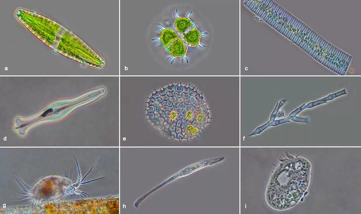 Фитопланктон диатомовые водоросли. Диатомовые одноклеточные водоросли. Инфузория Litonotus. Инфузория дидиниум.