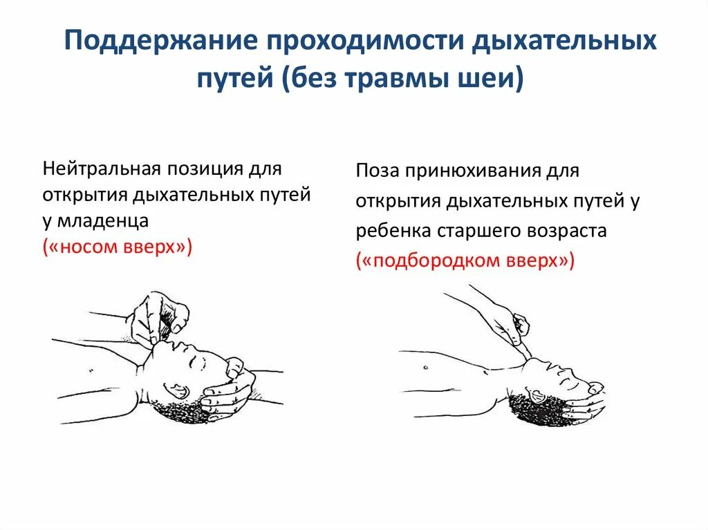 Поддержание свободной проходимости дыхательных путей. Методами восстановления проходимости дыхательных путей являются:. Методы обеспечения проходимости дыхательных путей. Методика восстановления проходимости дыхательных путей.