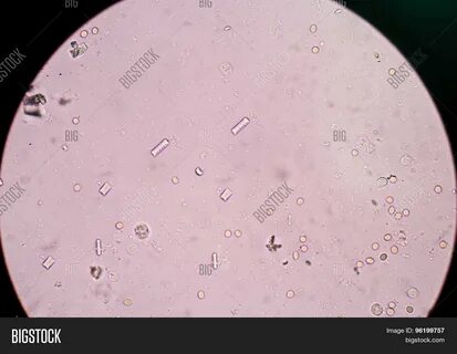 Triple Phosphate Image & Photo (Free Trial) Bigstock