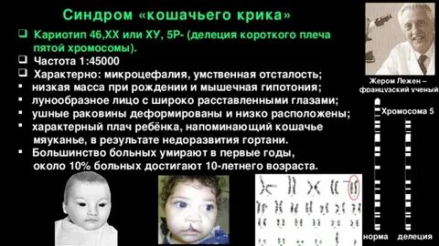 Синдром делеции