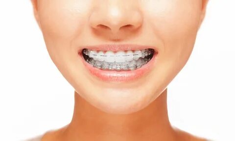 Treating TMJ With Orthodontics. 