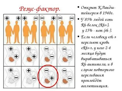 Резус 0