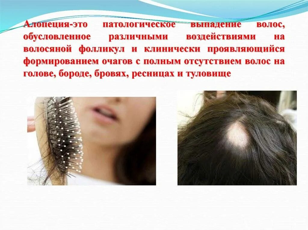 После наркоза выпадают. Заболевание волос алопеция. Выпадение волос факторы. Вызывающих выпадение волос.