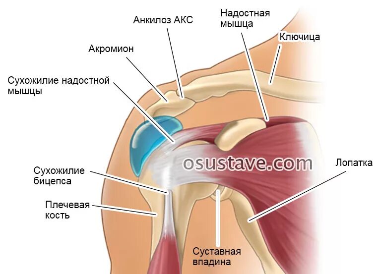 Артроз ключично акромиального сочленения плечевого. Артроз акромиально-ключичного сочленения сочленения. артроз акромиально-плечевого сочленения. артроз акромиально-ключичного сочленения 2-3 степени. анкилоз плечевого сустава.