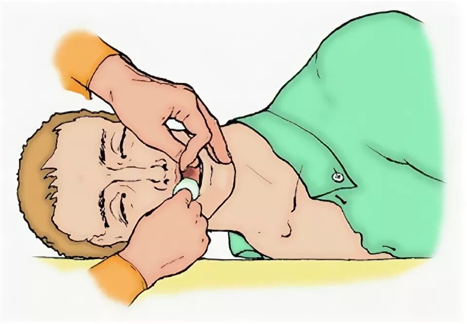 Удаление инородного предмета из дыхательных путей детей. Первая помощь при попадании инородного тела в дыхательные пути. Инородное тело в дыхательных путях. Первая помощь при попадании инородного тела. Инородное тело в дыхательных путях прием геймлиха.