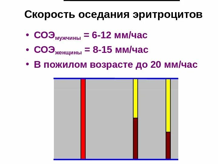 Метод вестергрена. Метод исследования соэ метод панченкова. Скорость о едания эритроцитов что. Соэ по панченкову у женщин. Анализ метод панченкова соэ норма.