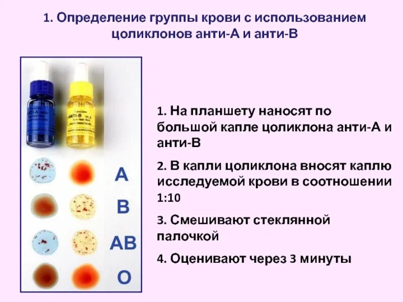 Методика определения групп крови по цоликлонам анти а и анти в. Определить группу крови цоликлонами таблица. Определение группы крови с помощью цоликлонов анти-а и анти-в. Методика определения группы крови цоликлонами оценка результатов. Таблица цоликлонов